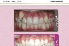 بیمار شماره 1