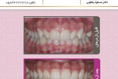 بیمار شماره 11