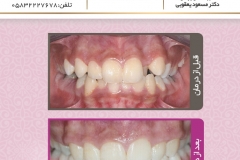 بیمار شماره 13