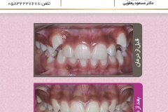 بیمار شماره 14