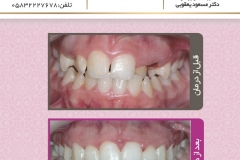 بیمار شماره 2