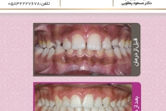 بیمار شماره 3