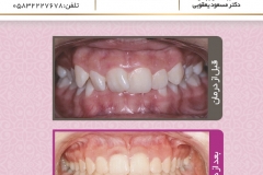 بیمار شماره 4