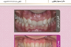 بیمار شماره 5