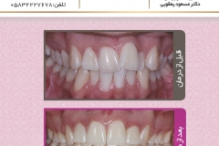 بیمار شماره 9